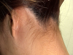 素人娘の全裸大図鑑 50人5時間　今時の女の子が恥じらいながら脱衣していくヘアヌードコレクション　サンプル画像17